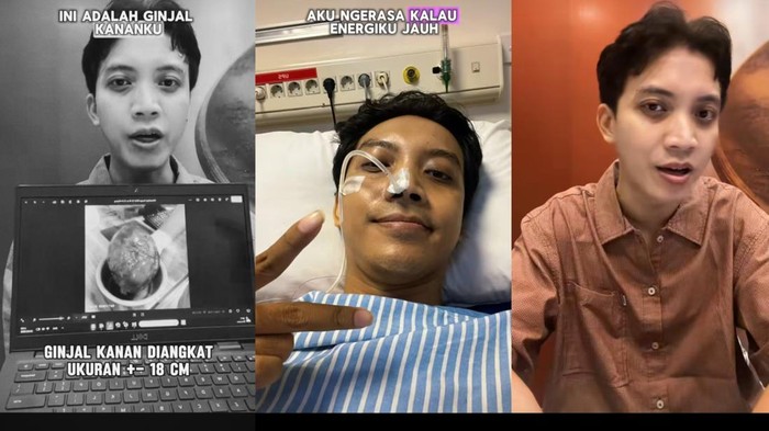 Viral! Pria Surabaya Kena Kanker Ginjal di Usia 30-an, Waspadai Gejala Awal yang Sering Diabaikan